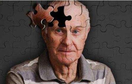 MRI可高效预测阿尔茨海默症患病风险