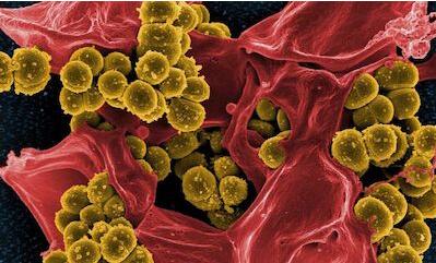 PNAS：如何应对耐药性金葡菌的感染？
