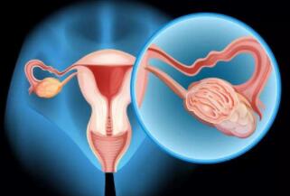 “妈眯缘”与常规改善卵巢功能产品有何不同？