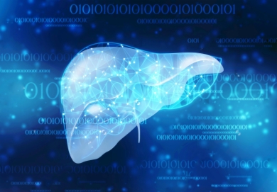 科学家开发出非酒精性脂肪肝新疗法