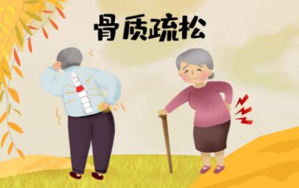 补肾抗衰系列谈—— 人老腿先老,骨骼衰老从35岁开始