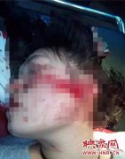 河南一女医生被砍七刀 行凶者与其无瓜葛(图)